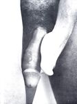 B AND W 1978 Photos