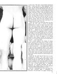 CIRCUMCISION PRO AND CON Photos