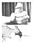 CIRCUMCISION PRO AND CON Photos