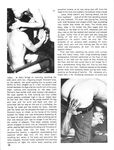 CIRCUMCISION PRO AND CON Photos