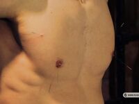The Cheated Patient - Part Ii - RusCapturedBoys - Military