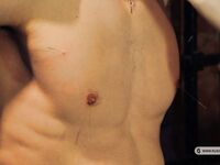 The Cheated Patient - Part Ii - RusCapturedBoys - Military