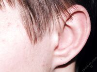 Kolya - 19nitten, 19zone - Twinks