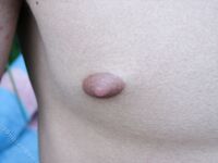 Vitold - 19nitten, 19zone - Latino